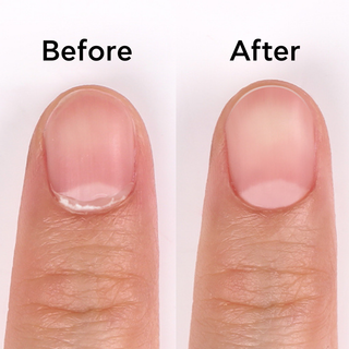 Bluesky Cuticle Remover - 30ml